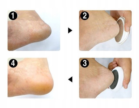 Pilnik do pięt Ped Egg pilniczek do stóp